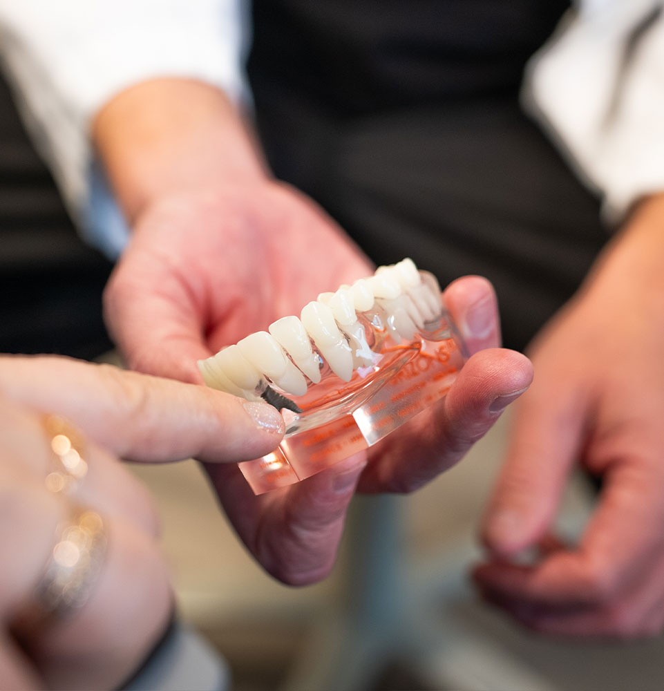 full arch dental implant model close up